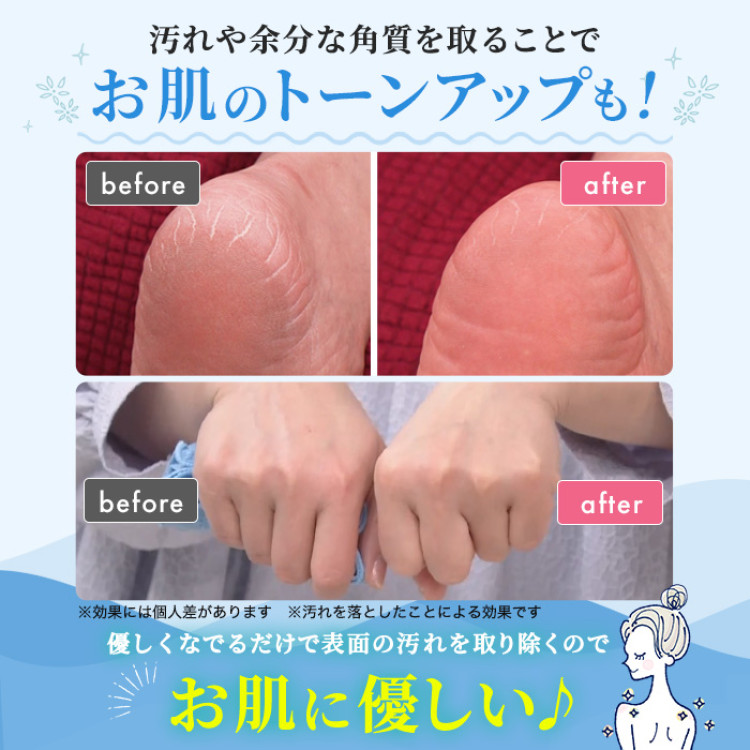 ゴムポンつるつる特別セット