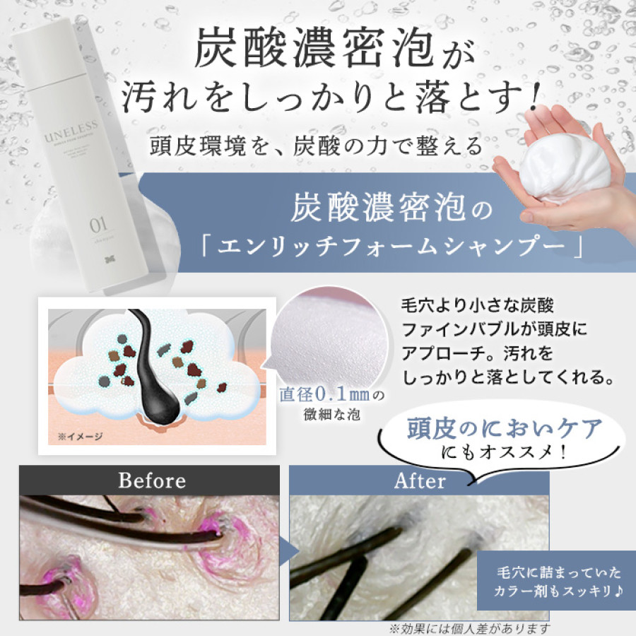 UNELESS ウネレス 特別セット