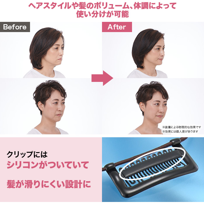 スマイルクリップ