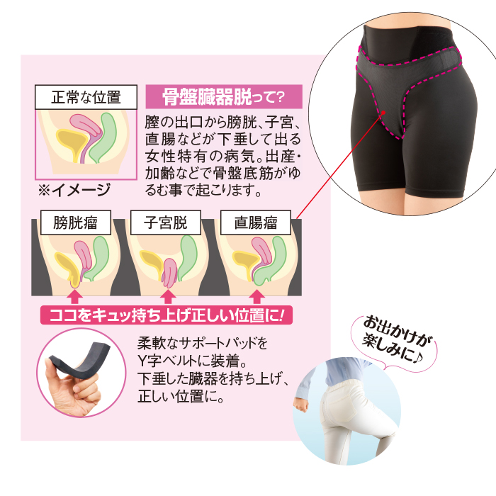 骨盤臓器脱サポーター